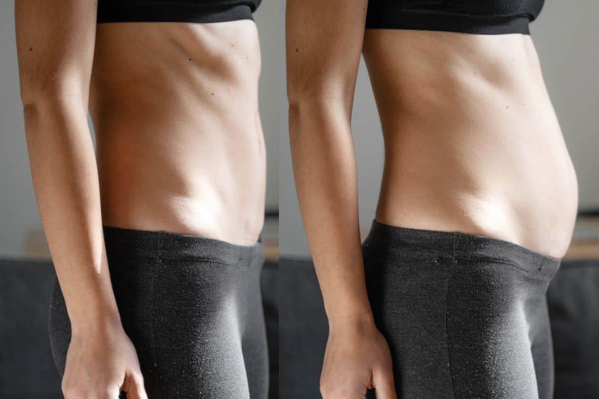 How long does diastasis recti take to improve Berkshire?