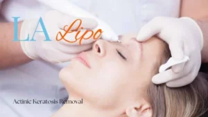 Woman receiving Actinic Keratosis Removal Treatment Berkshire