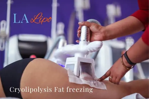 women getting fat freezing Berkshire