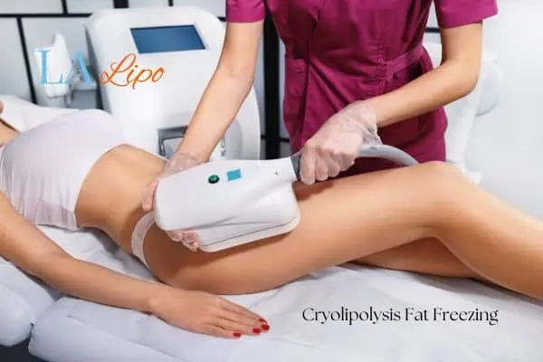 Woman receiving coolsculpting Berkshire treatment on her thighs