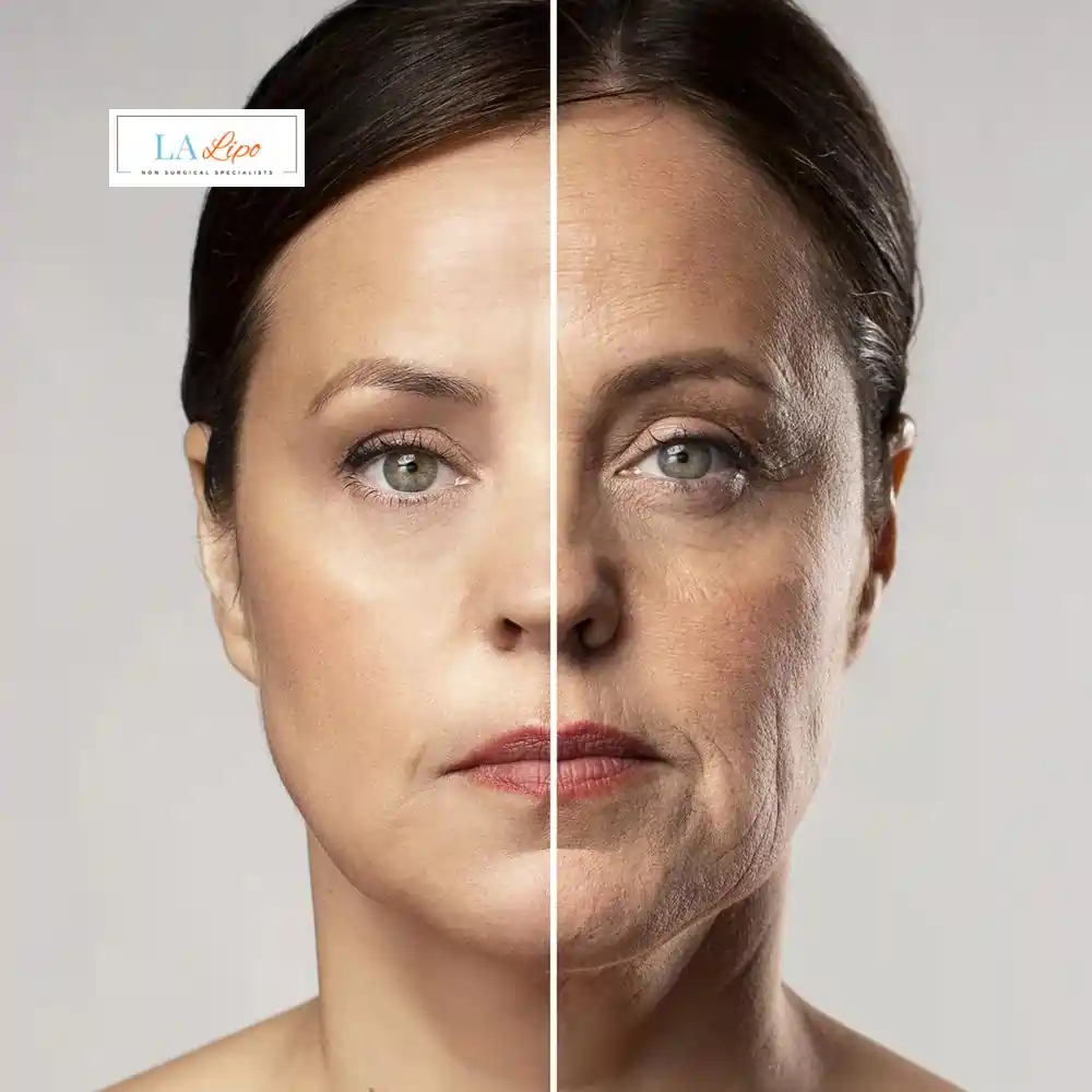 How Can You Tell If Non-Surgical Skin Tightening Is Right for You Berkshire?