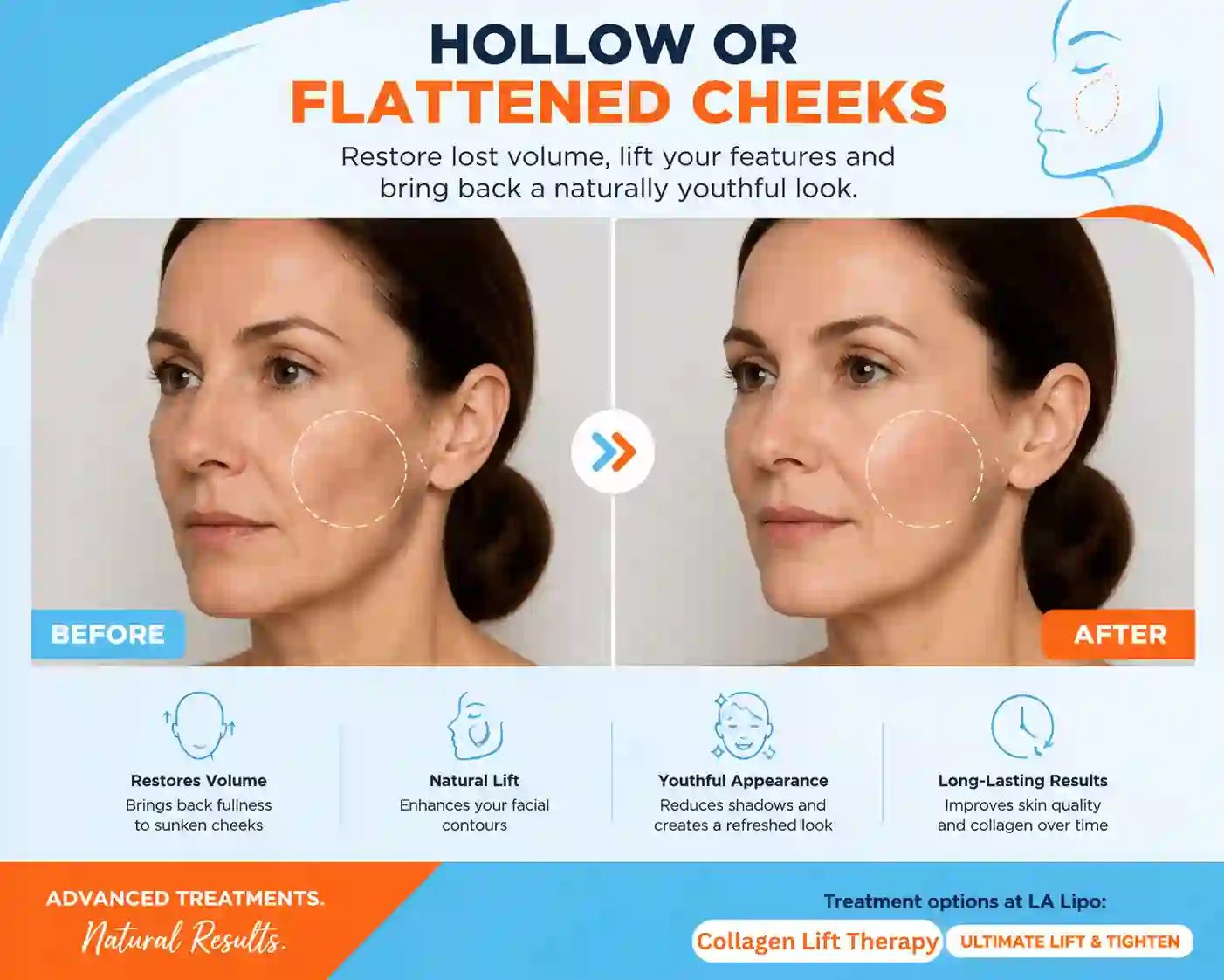 Sign #4: Hollow or Flattened Cheeks Berkshire