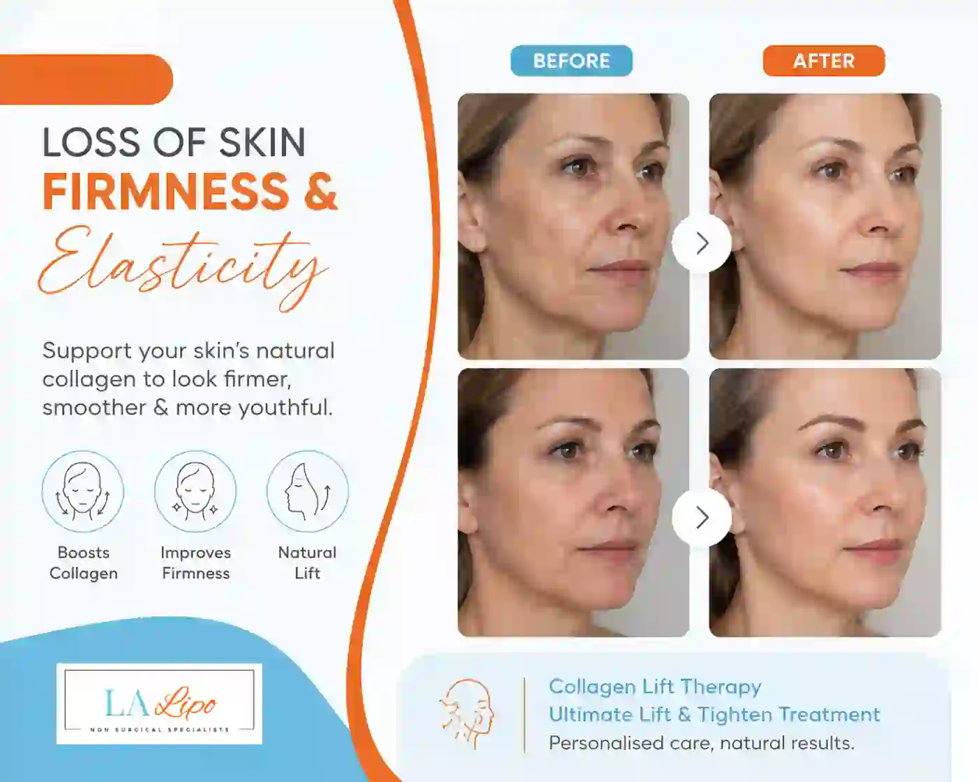 Sign #7: Loss of Skin Firmness and Elasticity Berkshire