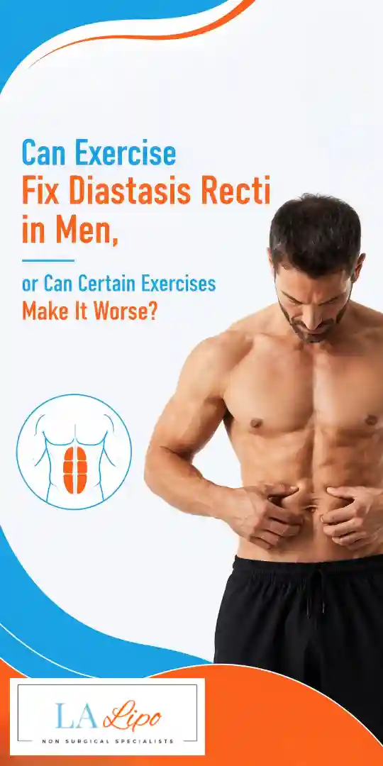 Can Exercise Fix Diastasis Recti in Men, or Can Certain Exercises Make It Worse Berkshire?